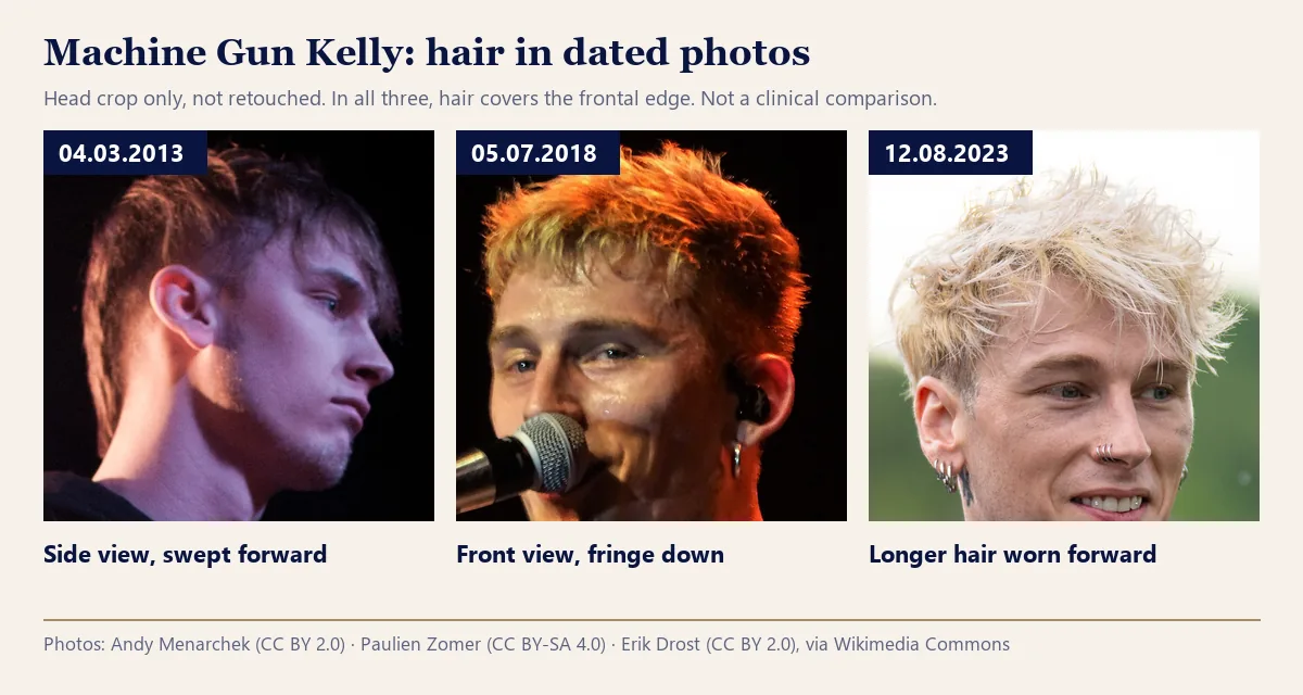 Machine Gun Kelly hair before and after in dated photos from 2013, 2018 and 2023