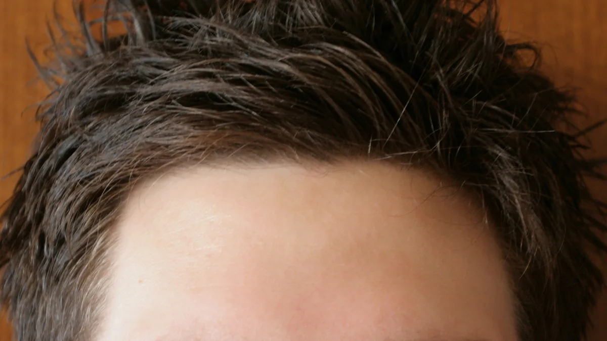 Close view of a man's forehead and frontal hairline with tousled dark hair