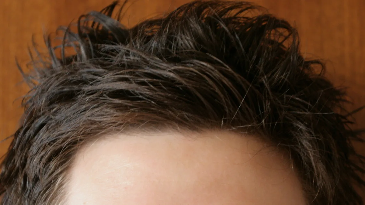 Front hairline of a man seen from above the eyebrows, with dark hair brushed up and back over a smooth forehead