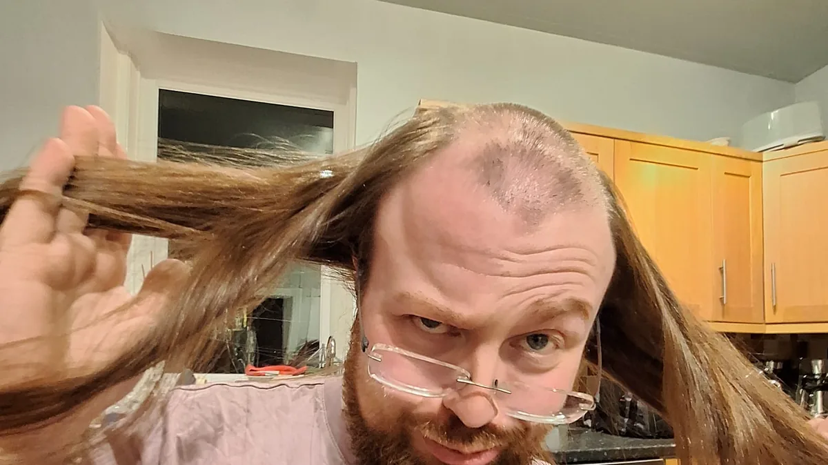 Man with a thin, mostly bare top of the head holding up long hair that grows from the sides