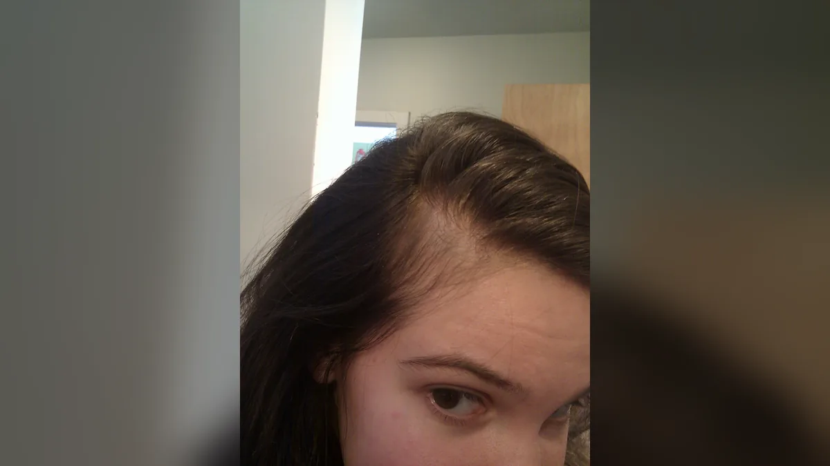 Woman's hairline with visible hair thinning at the temple