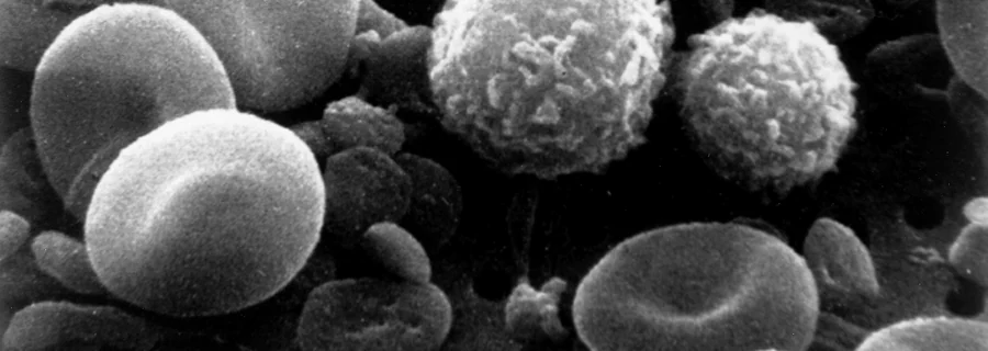 Electron microscope image of human blood showing red blood cells, white blood cells and small platelets