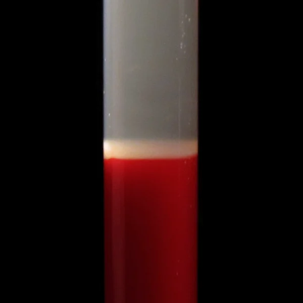 Test tube of centrifuged blood: grey plasma on top, a thin pale band of platelets and white cells, and red cells below