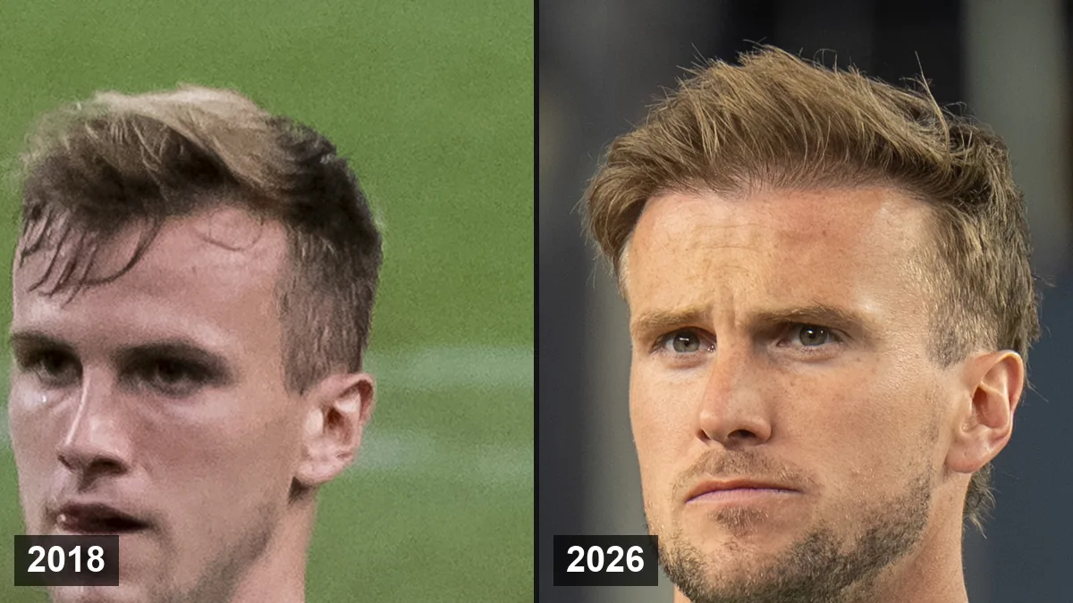 Rob Holding en 2018 (à gauche) et en 2026 (à droite)