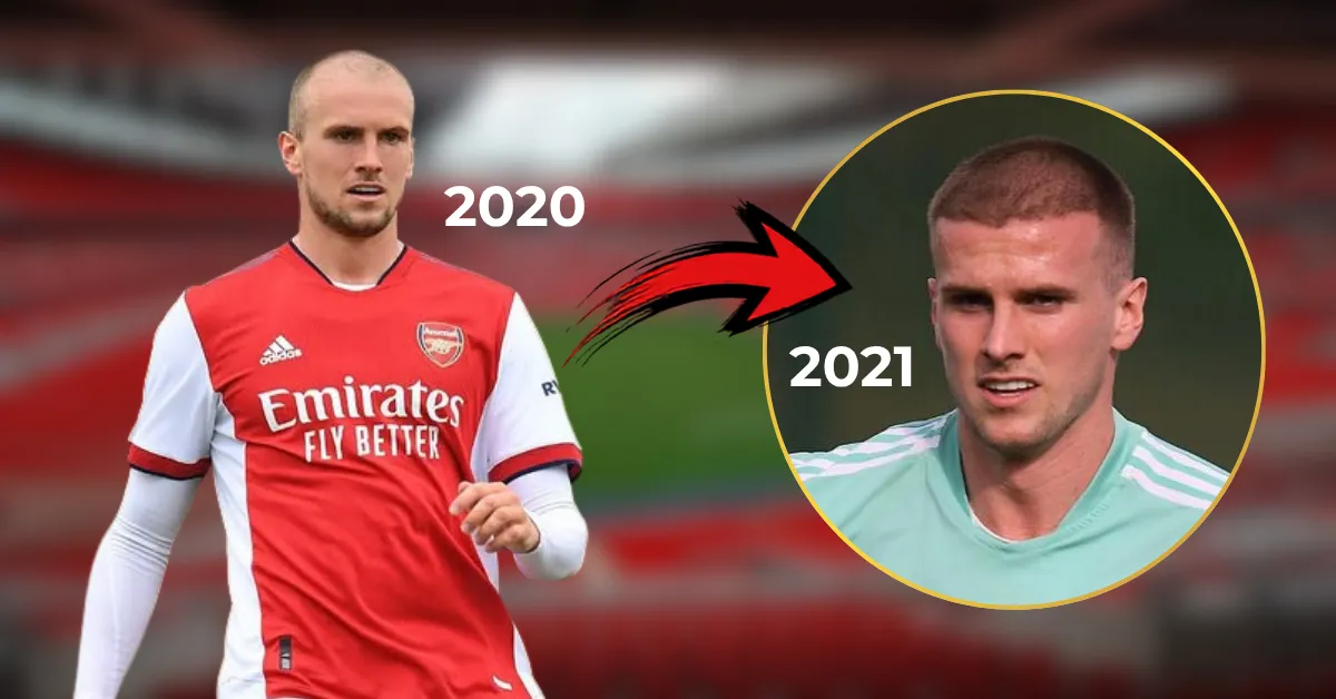 Rob Holding hairline transformation, Rob Holding 2020 2021 hairline, Rob Holding before after hair, Rob Holding hair density change, Rob Holding hair restoration, footballer hairline analysis