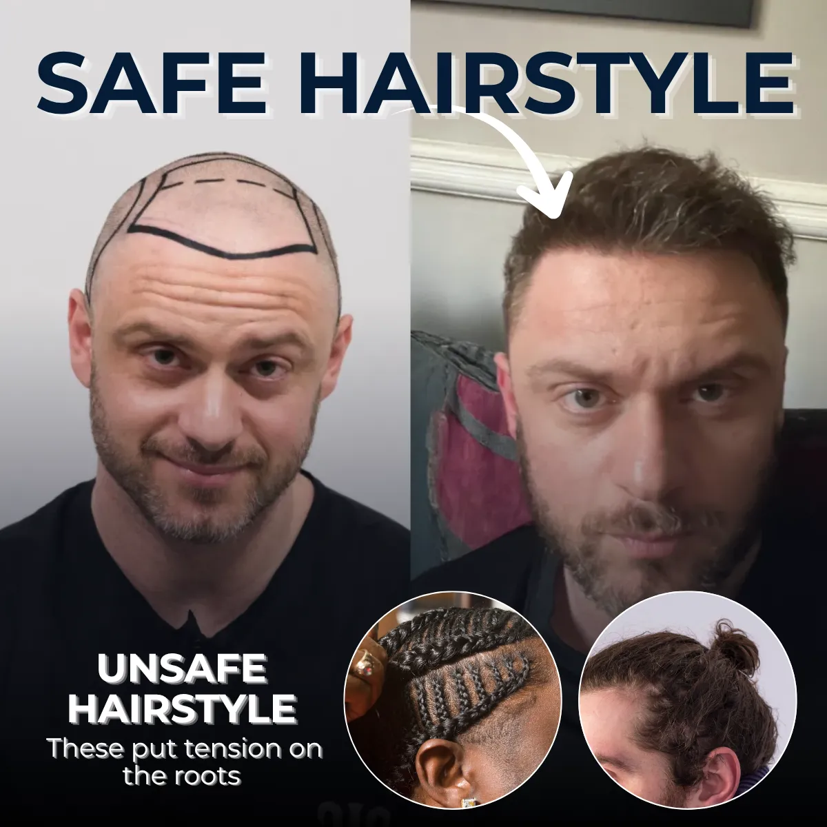 safe hairstyles for hair, unsafe hairstyles tension, hairstyle hair damage, traction alopecia hairstyles