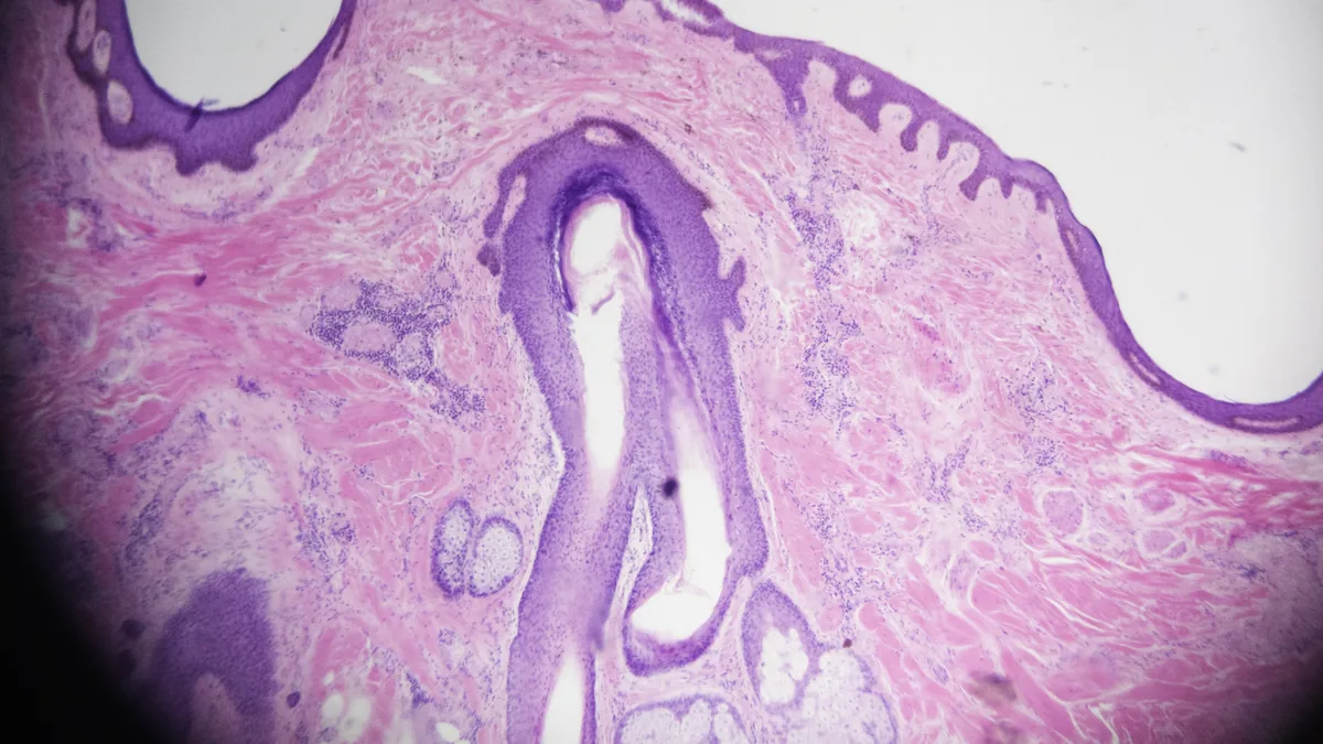 Coupe colorée de cuir chevelu humain au microscope optique, avec un follicule pileux qui descend dans le derme