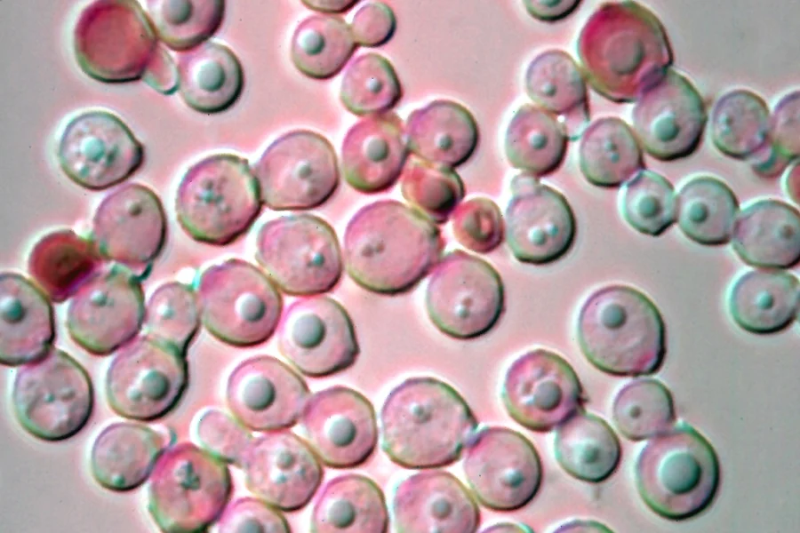 Round, budding yeast cells of Malassezia globosa under a microscope