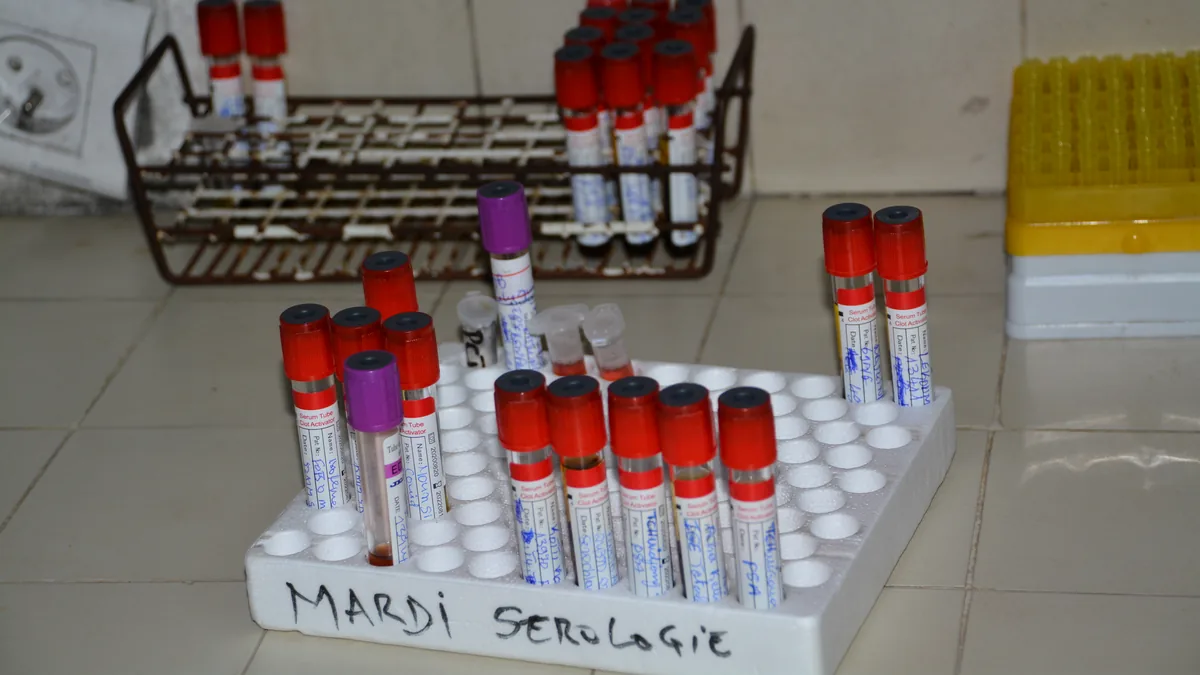 A white rack of blood collection tubes with red and purple caps and a handwritten serology label, in a hospital laboratory