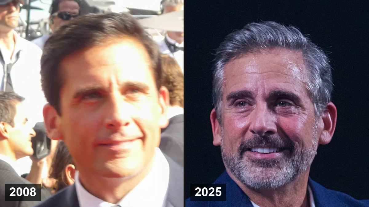 Greffe de cheveux de Steve Carell: Analyse et la ligne frontale Greffe de cheveux de Steve Carell: Analyse et la ligne frontale Hair Transplant hair transplant analysis