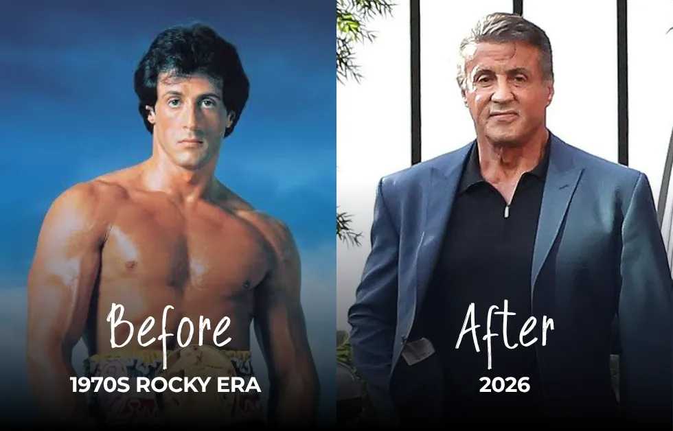 Sylvester Stallone Hair Transplant: Before & After