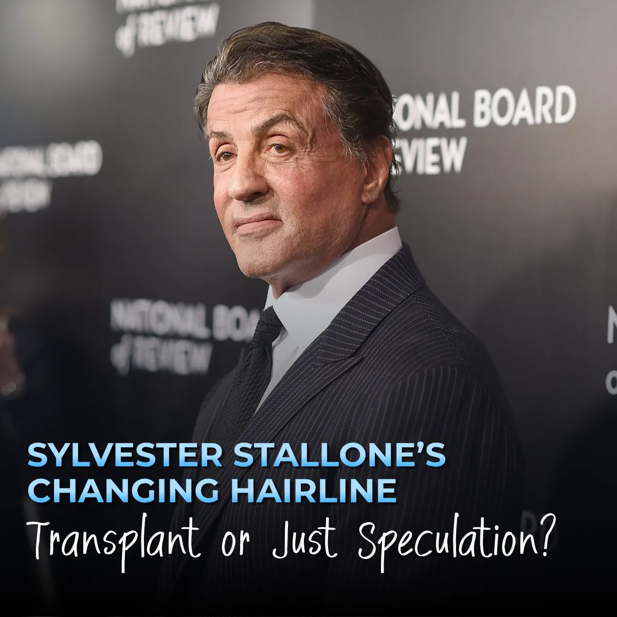 Sylvester Stallone Hair Transplant: Before & After
