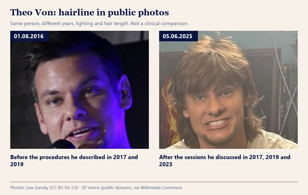 Theo Von hairline compared in dated photos from 01.08.2016 and 05.06.2025