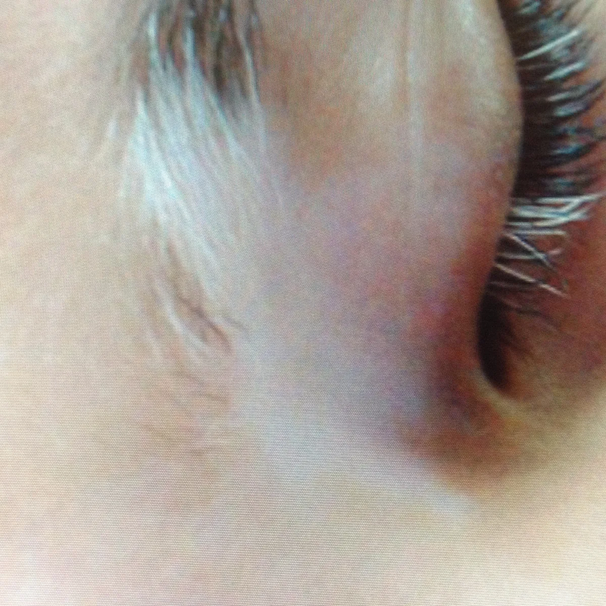 Close-up of a closed eye with white eyelashes and white hairs in the eyebrow above it, on pale skin