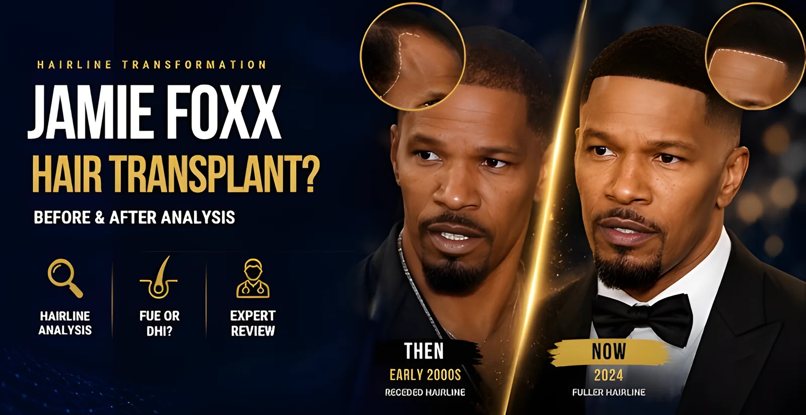 Jamie Foxx Hair Transplant: Before & After Hairline Analysis