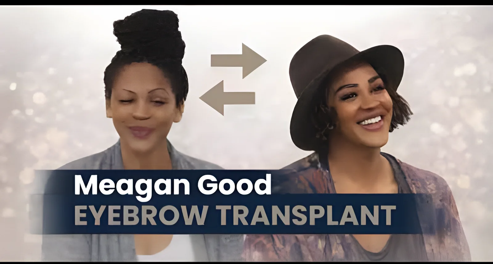 Meagan Good Eyebrow Transplant: Brows, Hairline & Beauty Transformation Explained