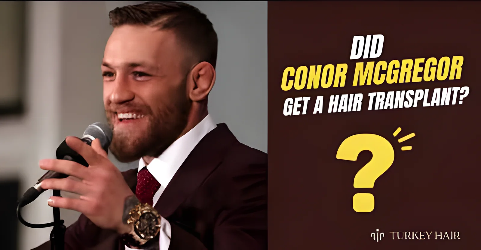 Did Conor McGregor Get a Hair Transplant? Expert Hairline Review