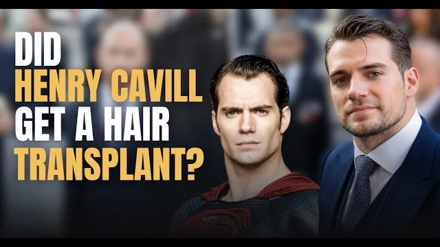 Expert Analysis