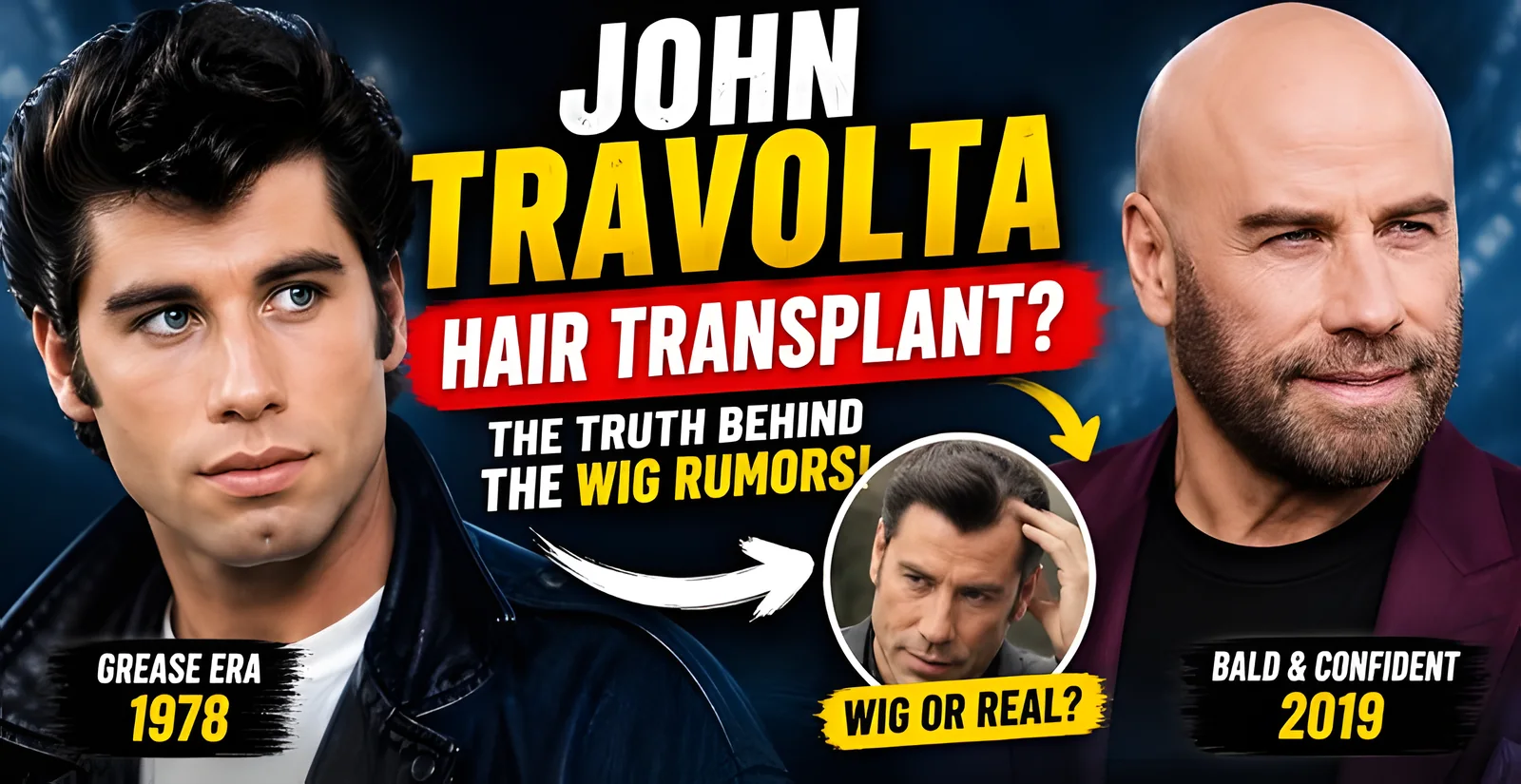 John Travolta Hair Transplant: Did He Really Get His Hair Back?