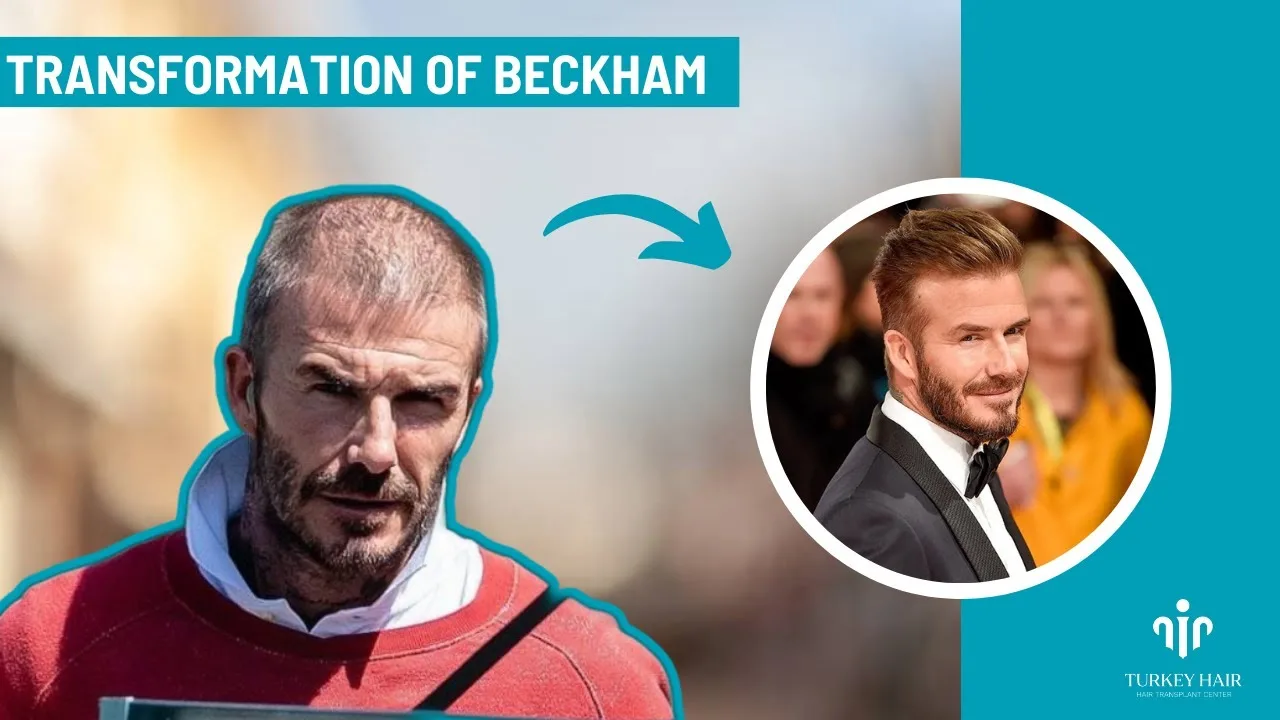 The Will and Influence of Beckham