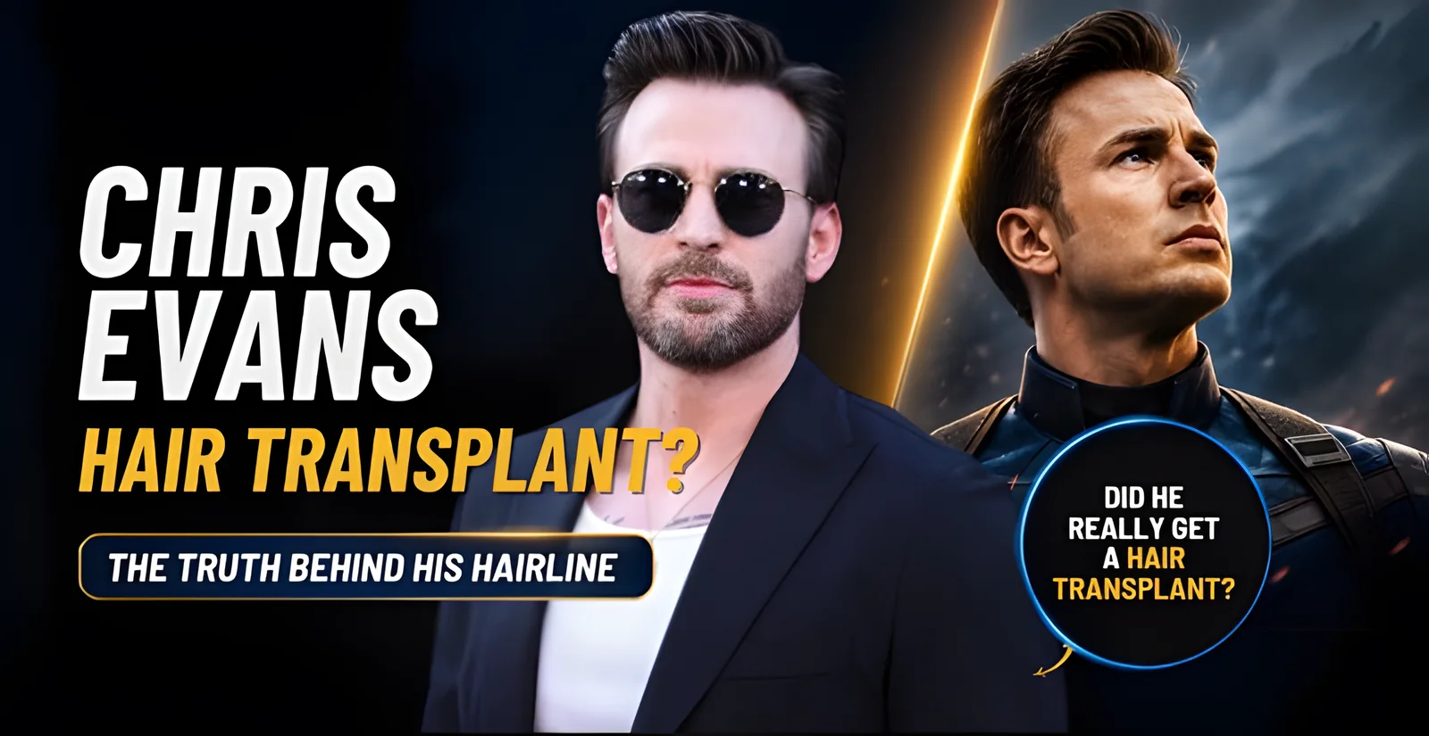 Did Chris Evans Really Get a Hair Transplant? Expert Hairline Analysis
