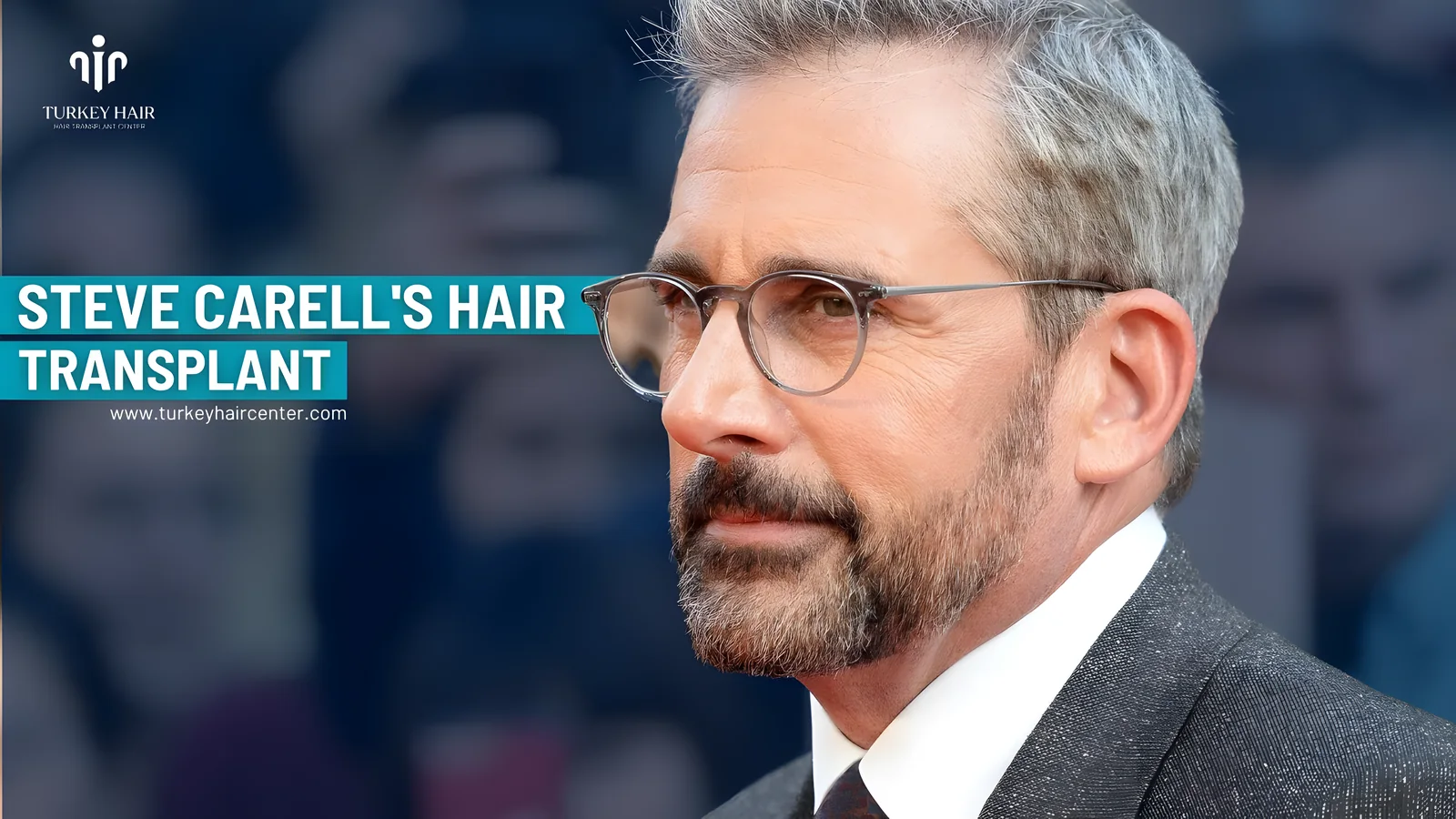 #1 Actor Steve Carell’s Hair Transplant | #turkeyhairtransplant