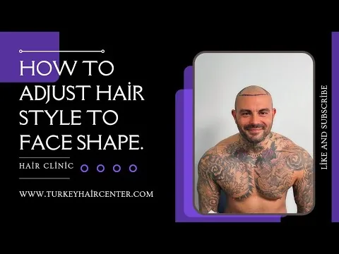 Advanced Hair Loss (Norwood Stage 5, 6, 7)