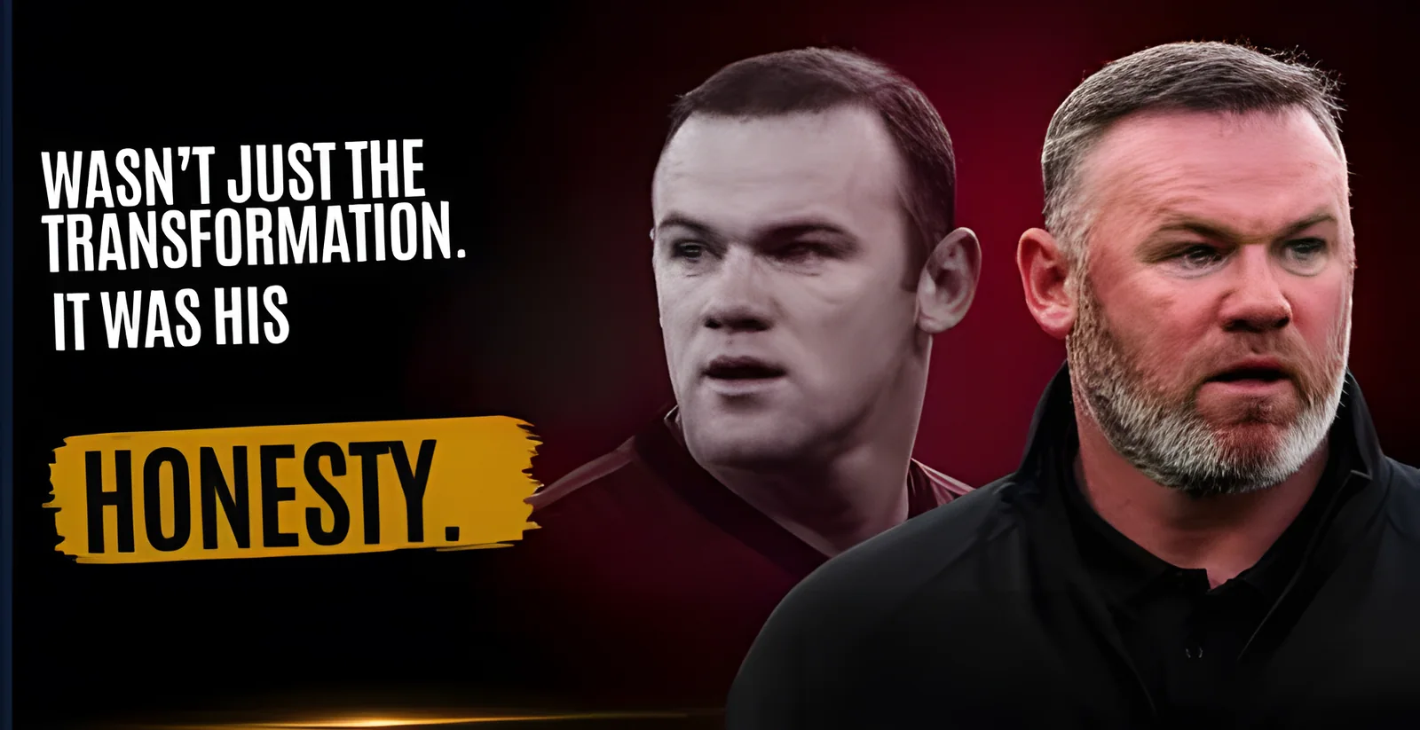 Wayne Rooney Hair Transplant: Before, After & Real Story Explained