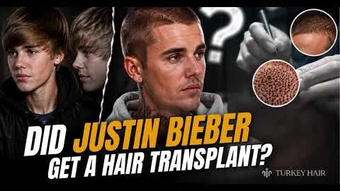 How Did Justin Bieber ’s Hair Look Different Over the Years?