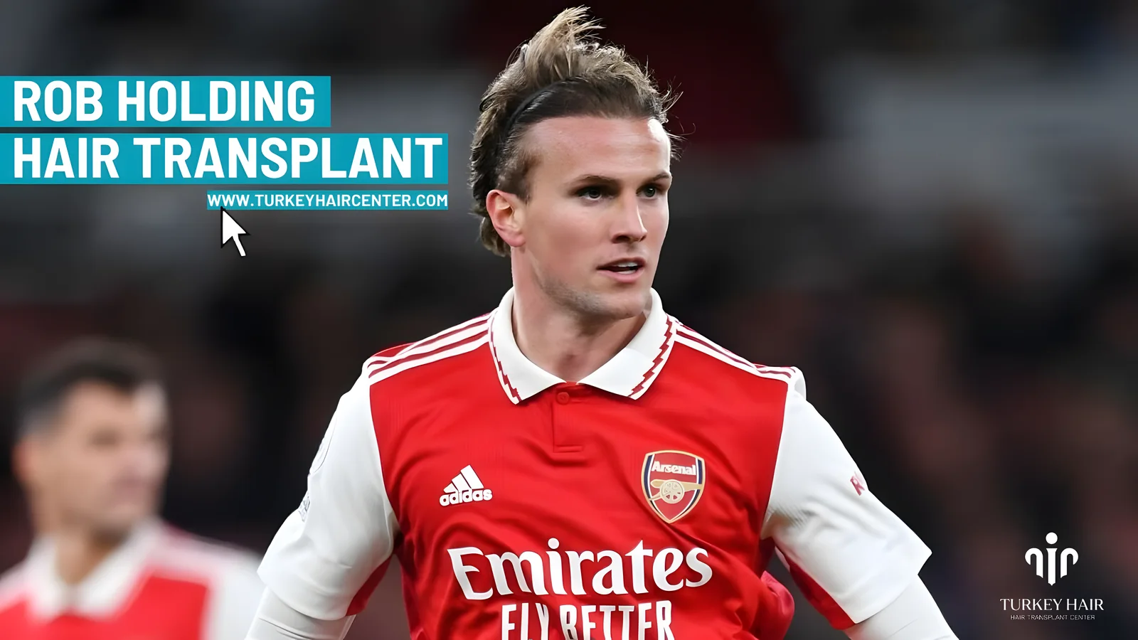 Rob Holding's Hair Transplant Transformation!