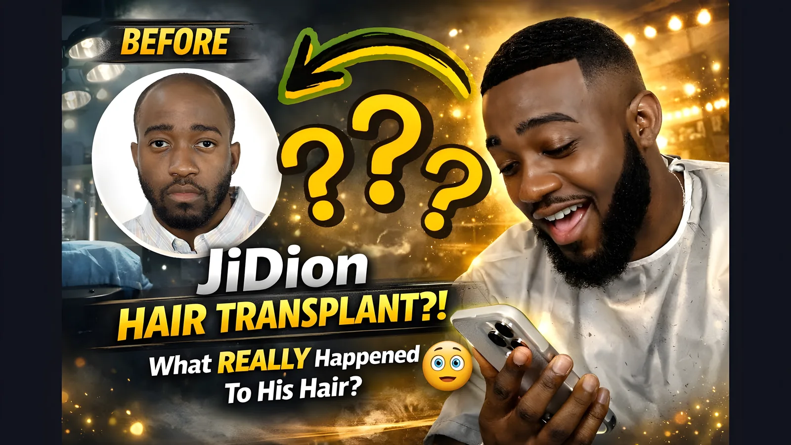 JiDion Hair Transplant: Did He Really Fix His Hair? | Before & After Analysis