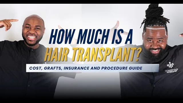 Hair Transplant Cost by Technique: FUE, FUT, DHI, and NeoGraft