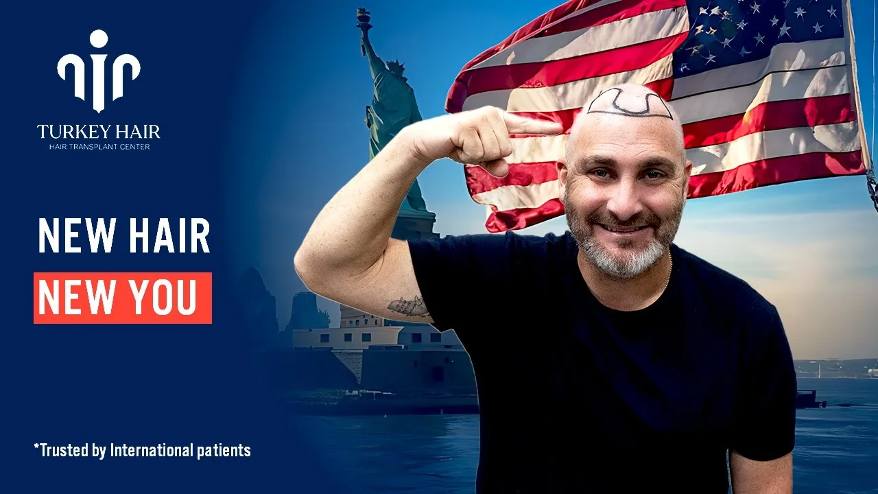 Who Is a Good Candidate for Dhi Hair Transplant?