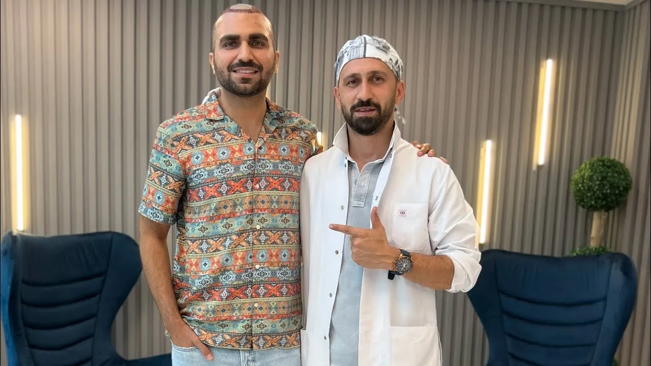 What is Beard Transplant?