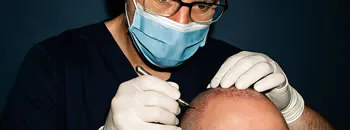 FUE Hair Transplant