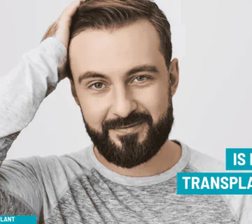 Body Hair Transplant