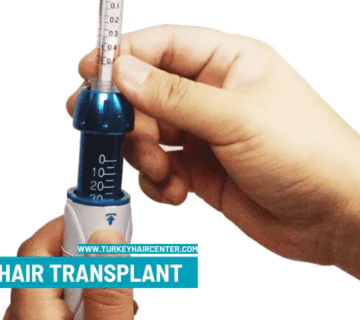 Scar Hair Transplant