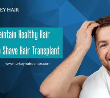 No Shave Hair Transplant