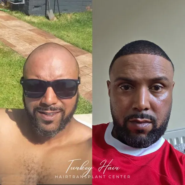 Ezra Nathaniel Mckenzie