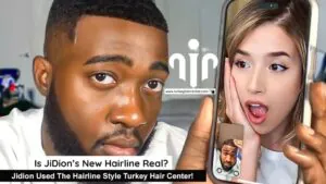 Jidion Adams Hair Transplant
